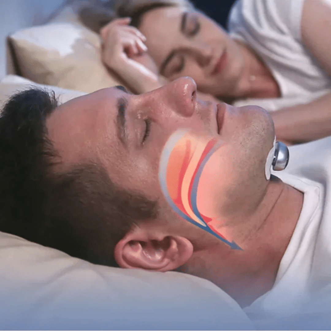 Snoring Device - Eliminates Snoring & Sleep Apnea